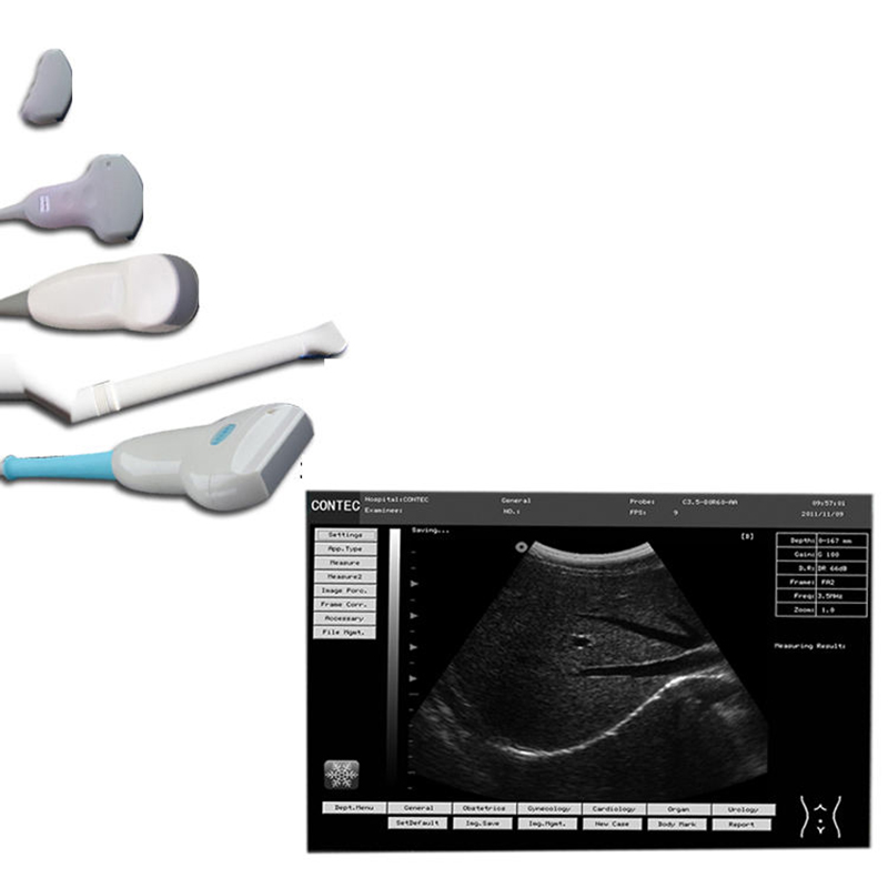 Veterinär-Ultraschall-Diagnosesystem CMS600P2VET