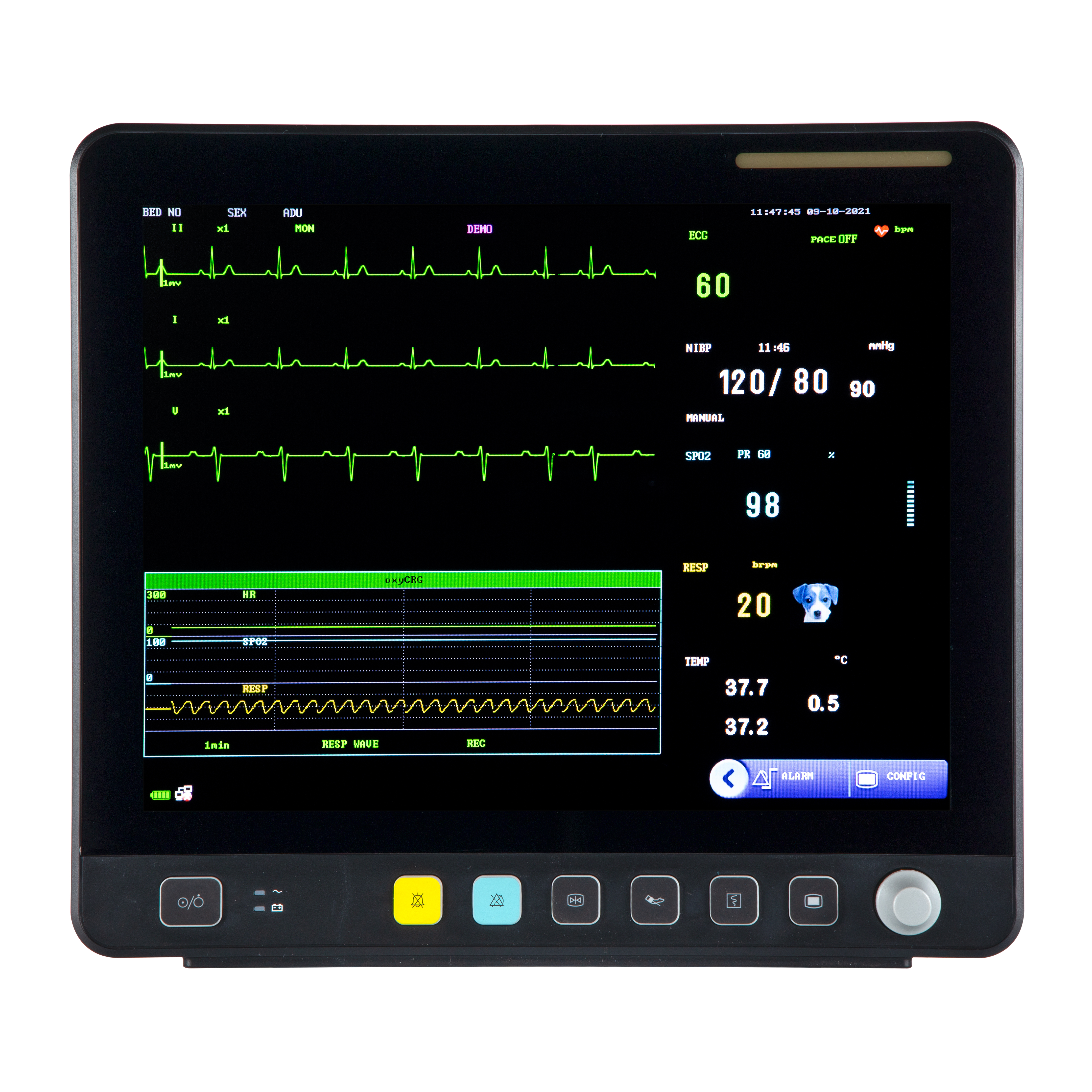 Veterinär-Touchscreen-Multiparameter-EKG-Monitor VE15