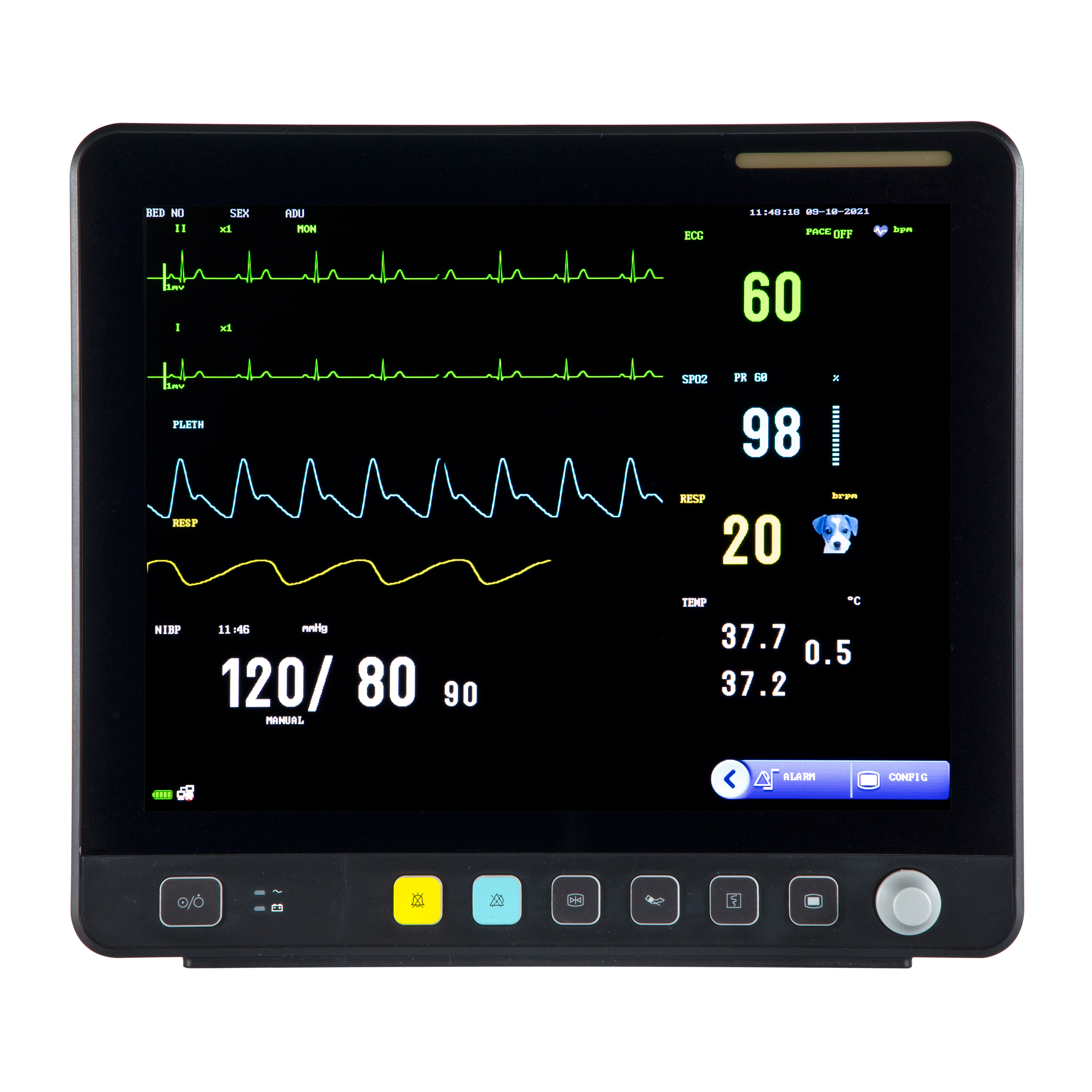 Veterinär-Touchscreen-Multiparameter-EKG-Monitor VE15